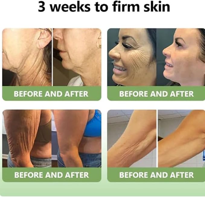 Luxelift⢠Collagen Firming Body Cream (Pack of 2)